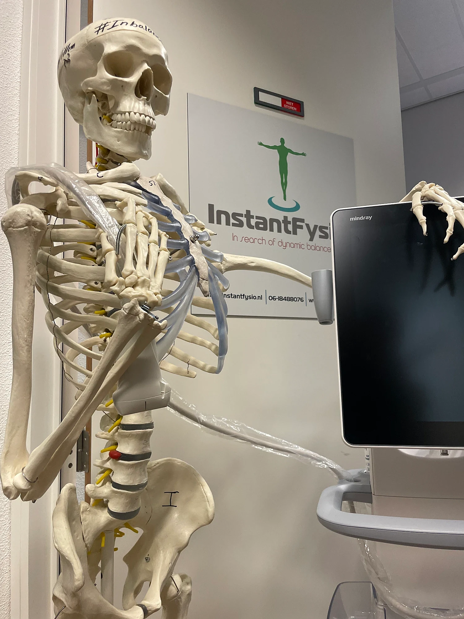 Echografieapparaat naast een skeletmodel in de praktijk